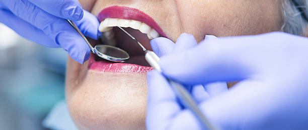 Best Emergency Gum Treatment in Killen, AL